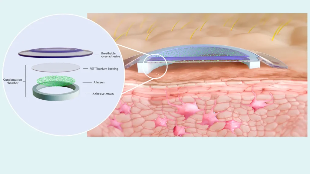 How the Viaskin® patch works How the Viaskin® patch works